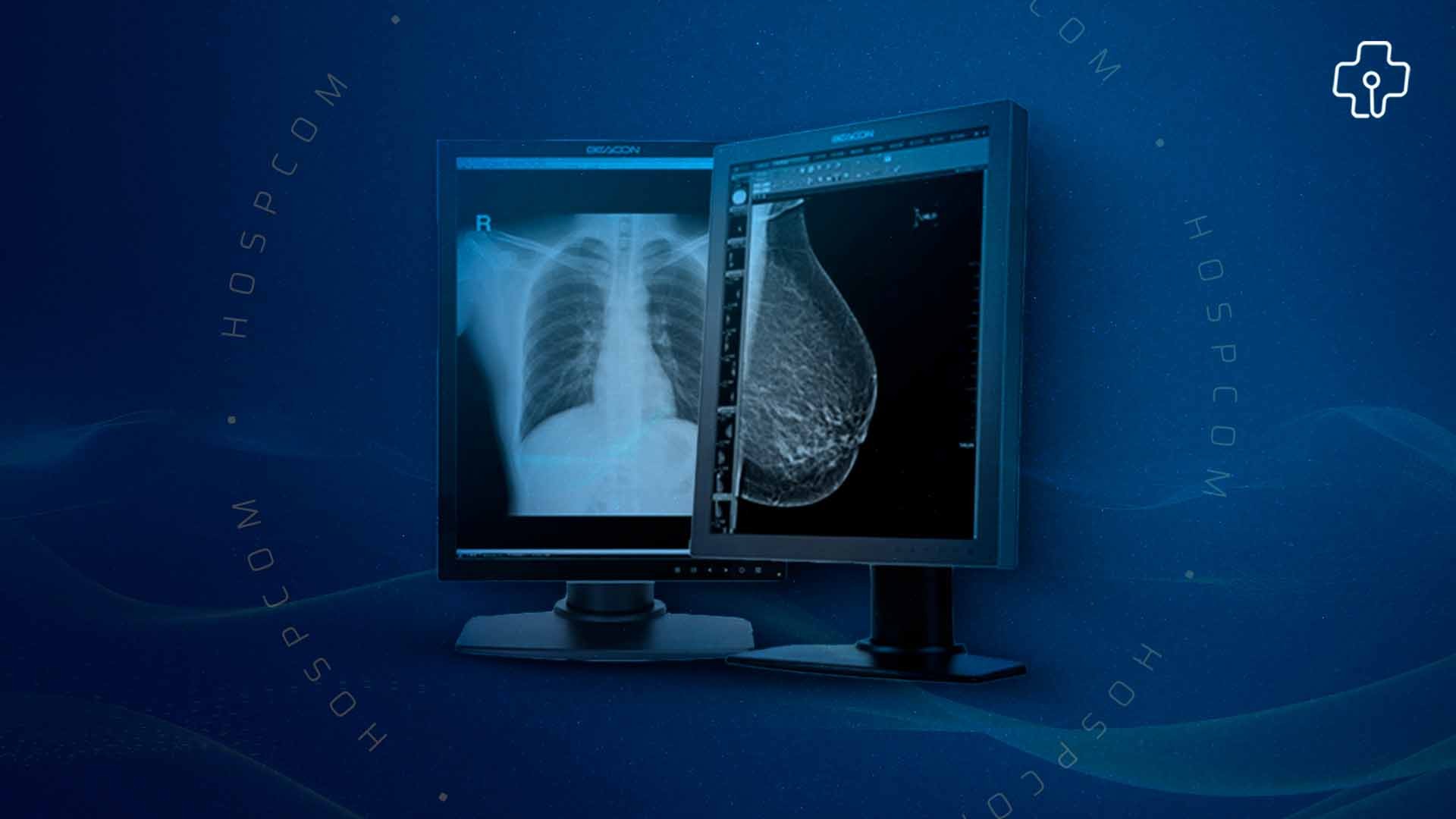 Monitores Médicos Beacon: Alta Definição e Precisão para Diagnóstico e Procedimentos